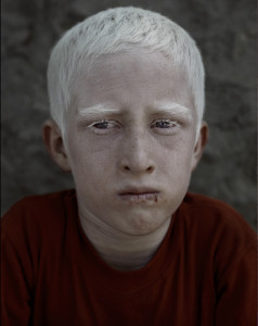 Afghan albino boy in Kabul portrait by photographer Kenneth Rimm